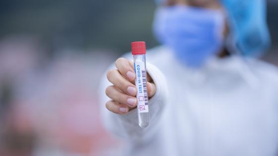Test coronavirus