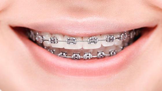 brackets